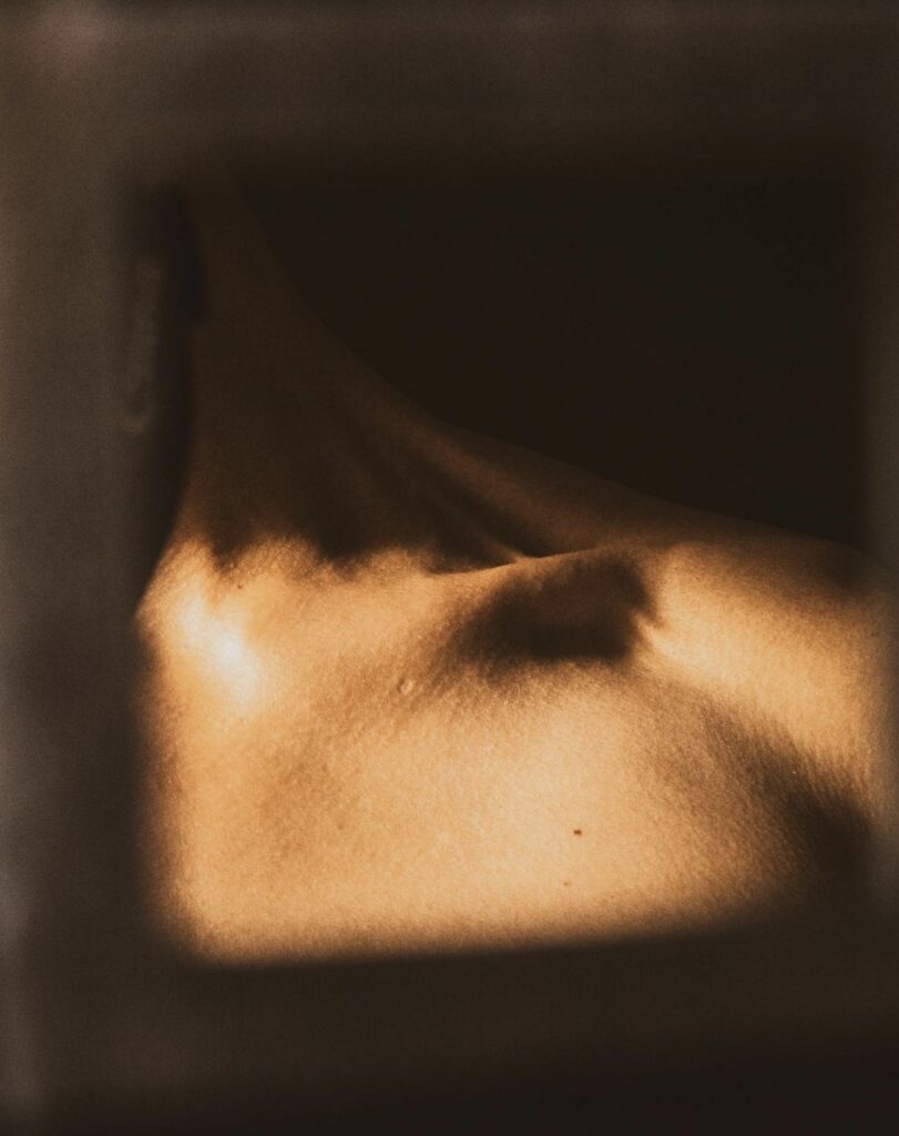 Picture of shoulder